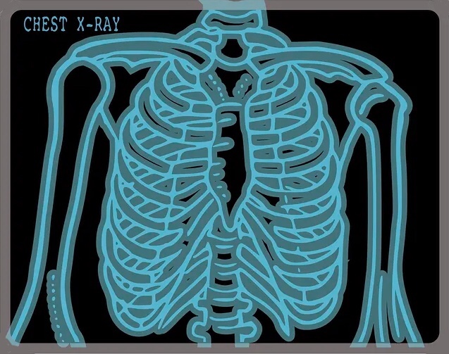 Chest X-ray clipart, medical illustration vector. Free public domain CC0 image.