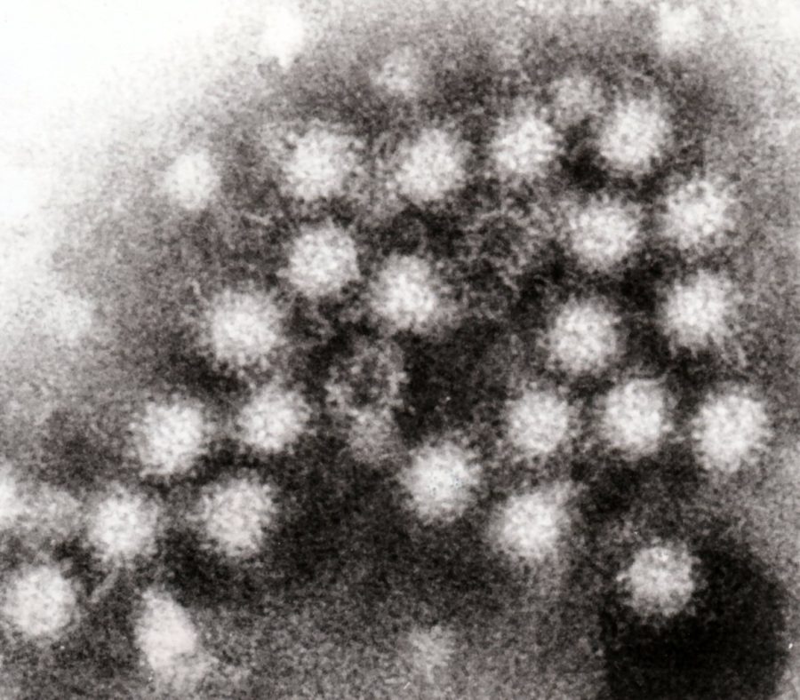 Norovirus Outbreak
