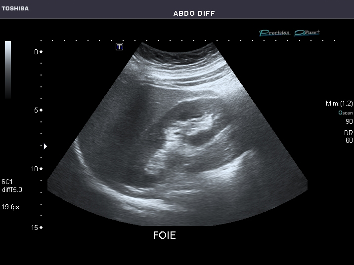 Ultrasound Technicians: What Do They Do?